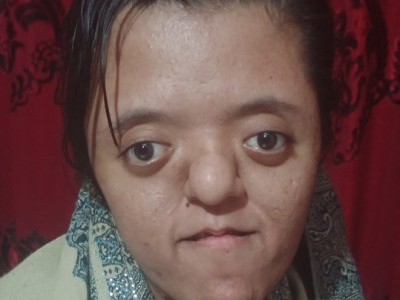 Help me to fight with down syndrome