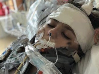 Help my friend Anuska fight Accident(Multiple Fractures/Polytrauma)